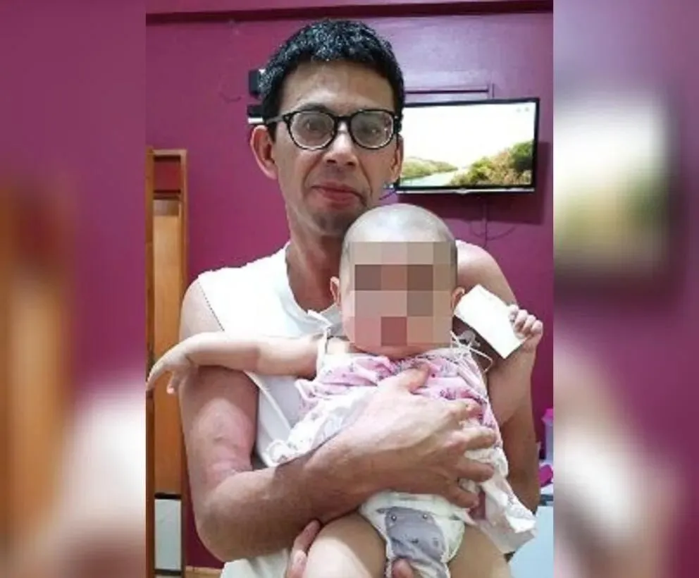 A Dionisio lo operaron en el hospital Argerich y a Justina en el Garrahan. Foto gentileza.