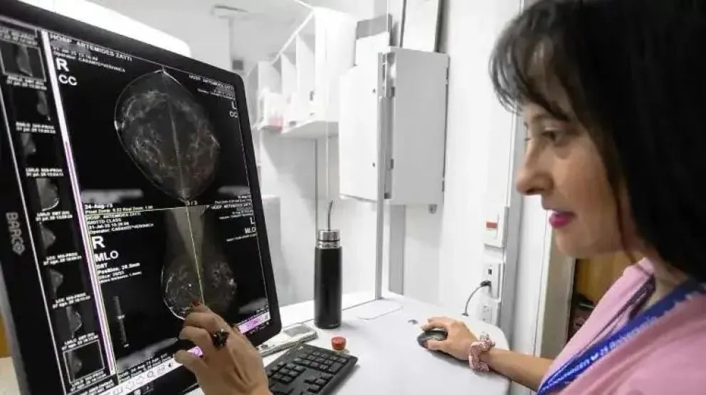 Durante octubre, mujeres de 50 a 69 años podrán acceder a mamografías gratuitas y sin orden médica en hospitales públicos de Río Negro, entre ellos el de Choele Choel. Foto: gentileza.